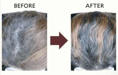 PuraLity Health Hair Renewal Results