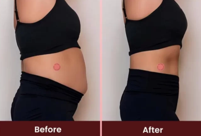 LeviaPatch UK Before & After